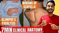 klumpkes paralysis clinical anatomy of brachial plexus | winging of scapula clinical anatomy