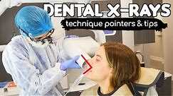 How To Take PERFECT Dental X-rays | Tips & Tricks From A Dental Hygienist