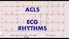 ACLS - ECG rhythm recognition & management, Part 1