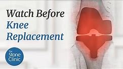You Likely Don't Need A Knee Replacement (80% Don't)