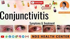 Conjunctivitis (Pink Eyes) Eye Flu | Symptoms & Treatment | Dr. Zarna Patel | New Diet System NDS