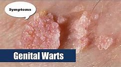 Genital Warts || HPV || Human Papilloma Virus || Women men#GenitalWarts #hpv #HumanPapillomaVirus