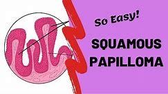 Squamous Papilloma | Oral Pathology Lectures