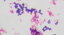 How to Do a Gram Stain