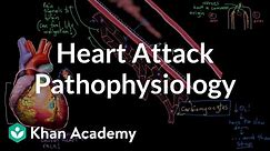 Heart attack (myocardial infarction) pathophysiology | NCLEX-RN | Khan Academy