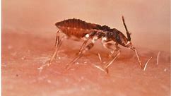 Choroba Chagasa. Śmiertelne schorzenie przenoszone przez robaki
