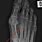 3rd Metatarsal Fracture