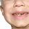 5 Year Old Teeth