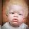 Albino Baby