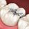 Amalgama Dental Zinc