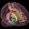 Amygdala Brain Scan