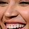 Beyonce's Teeth
