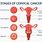 Carcinoma of Cervix