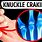 Cracking Knuckles Side Effects