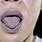 Cyanosis Tongue