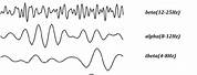 EEG Frequency Bands