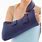 Elevated Arm Sling
