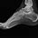 Foot X-ray Side View