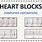 Heart Block EKG Examples