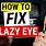 How to Fix Lazy Eye
