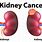 Kidney Cancer Types