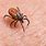 Lyme Disease From Ticks