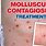 Molluscum Contagiosum Infection Treatment