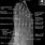 Oblique Foot X-ray Anatomy