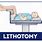 Patient Lithotomy Position