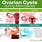 Post Menopausal Ovarian Cysts