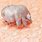 Scabies Itch Mite