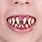 Scary Clown Teeth