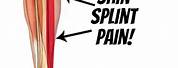 Shin Splint Pain Location