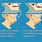 Upper Jaw Bone Loss