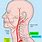 Vertebral Artery Location