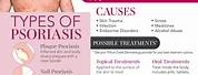 What Causes Plaque Psoriasis