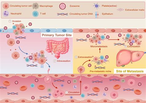 Potential value of detection of minimal residual disease in colorectal ...