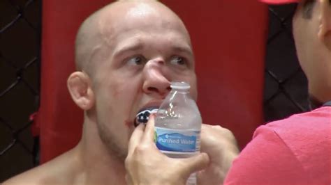 MMA fighter Blake Perry sustains horrific broken nose