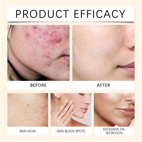 Jaysuing Vital Spray Serum 100ml Soothing Nourishing Mist Serum Facial ...