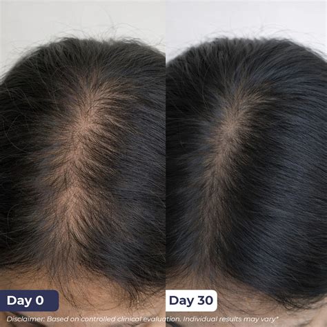 Shop Rosemary Hair Growth Spray | 200 ml | Flash Sale for Healthy ...