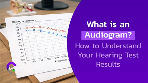 What Is an Audiogram? How to Read Your Results