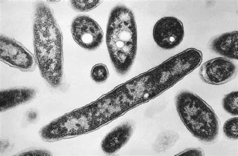 Legionella bacteria found in St. Louis Public Schools' central office