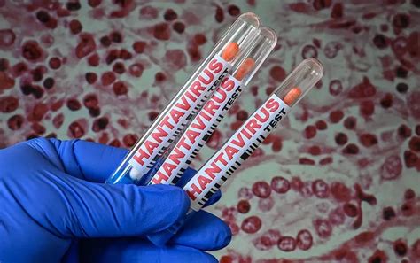India activates 165-lab network after cruise ship hantavirus cases