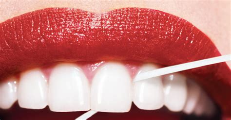 How to Fix Receding Gums | New Beauty