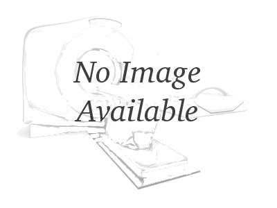 New ARTHREX AR-8718DS-1310 (Each) AR 8718DS 1310 AR 8718DS 1310 ...