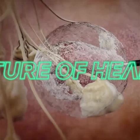 How tumor freezing is changing breast cancer treatment | Reuters