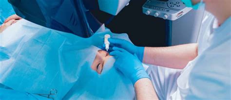 PRK Laser Eye Surgery: Benefits, Procedure, Recovery & Vision Correction