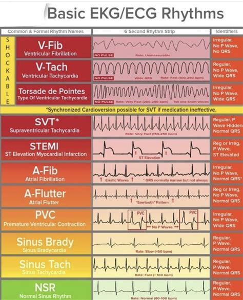 Ekg Electrode Placement - Face Surgery