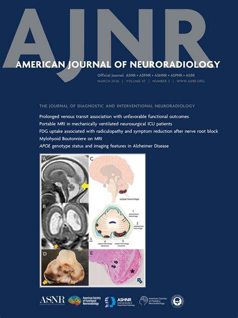 Low-Level Light Therapy Effect on Metabolites Measured by MR ...