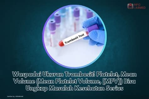 Mpv (Volume Trombosit Rerata): Indikator Esensial Di Laboratorium Medik
